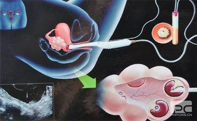 关于试管代生包性别
